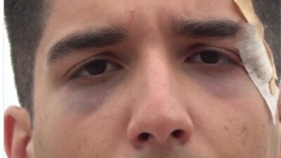 Trabzon’un Sürmene ilçesinde üniversite öğrencilerini darp ettikleri iddiasıyla gözaltına alınan