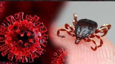 Sivas'ta, Kırım Kongo Kanamalı Ateşi (KKKA) hastalığı şüphesiyle tedavi gören