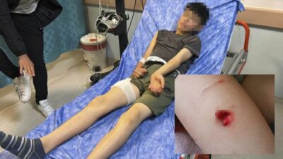 Sivas'ta başıboş köpeğin saldırısına uğrayan 13 yaşındaki çocuk yaralandı.