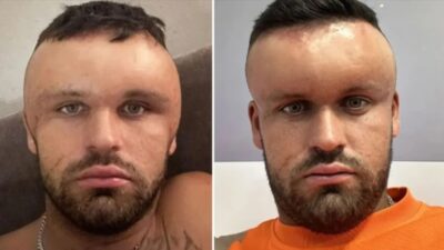 İngiltere'de 27 yaşındaki Ryan Briggs, annesinin aldığı saç boyasını deri