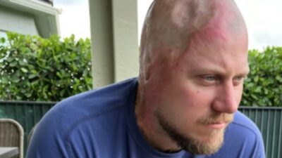 ABD'de 4 bin 160 voltluk elektrik akımına kapılan 36 yaşındaki