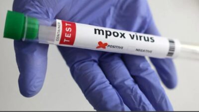 Belçika'da, maymun çiçeği virüsünün yeni varyantı Valon bölgesindeki bir hastada