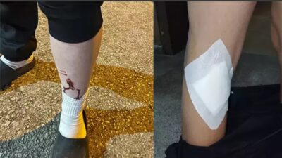 Ankara'nın Çubuk ilçesinde evlerinin bahçesinde oynayan çocuklara başıboş köpekler saldırdı.