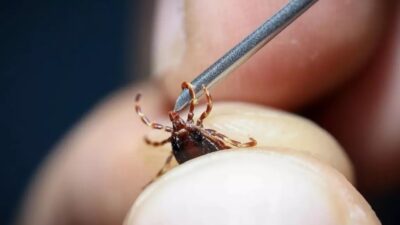 Sivas'ta vücuduna yapışan keneleri yanlış usullerle çıkartan bir kişi 10