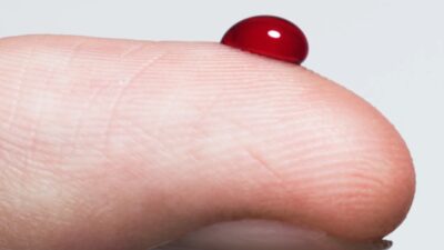 Genç kan serumu ve kemik iliği hücrelerinin laboratuvar deneylerinde cilt