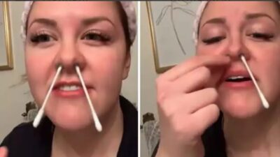 Burnundaki kıllar göründüğü için hepsine ağda yaptıran kadın, kısa bir