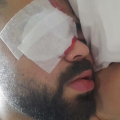 Gaziantep Koza Polyester’de Bir İhmal Bir Hayat Kararttı: Maliyeti Sadece