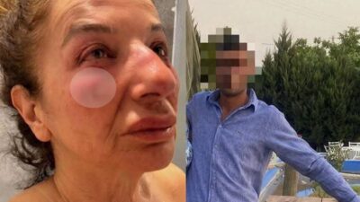 Hasta bir sokak köpeğine yardım etmek için bölgeye giden eczacı