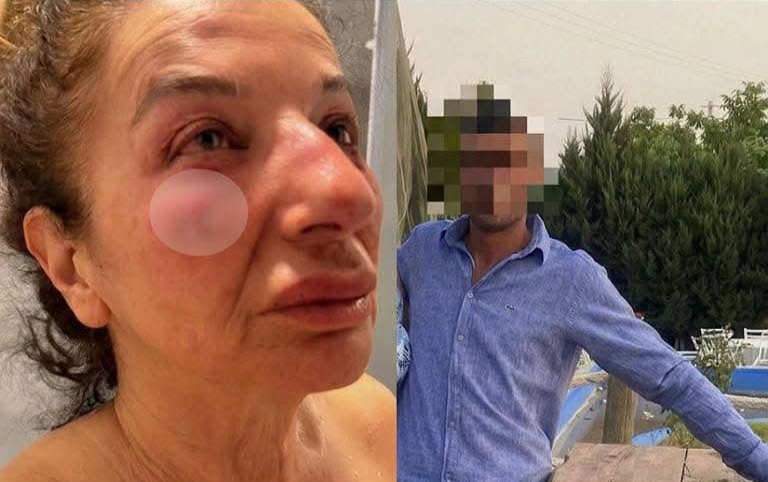 Hasta bir sokak köpeğine yardım etmek için bölgeye giden eczacı